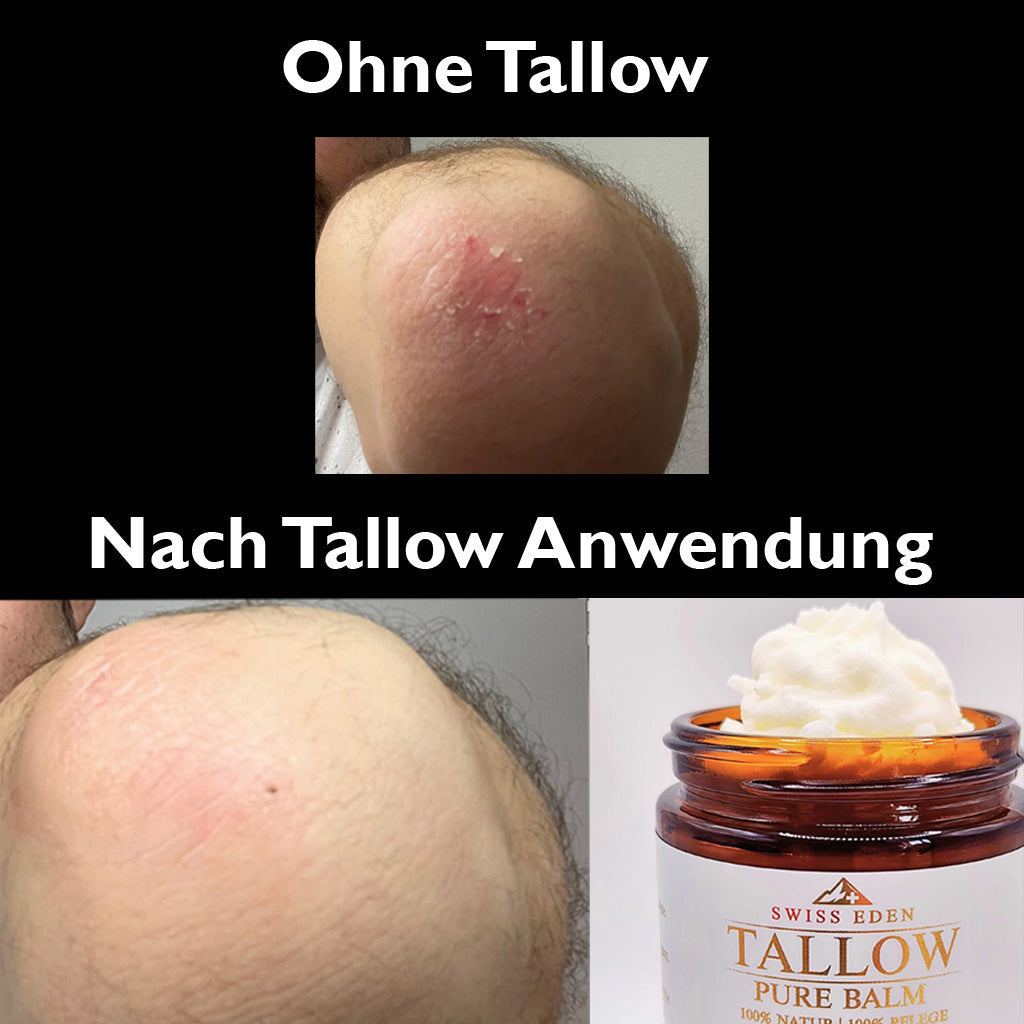 Wirkung von Tallow Balm pure